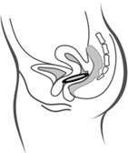 Figura 5